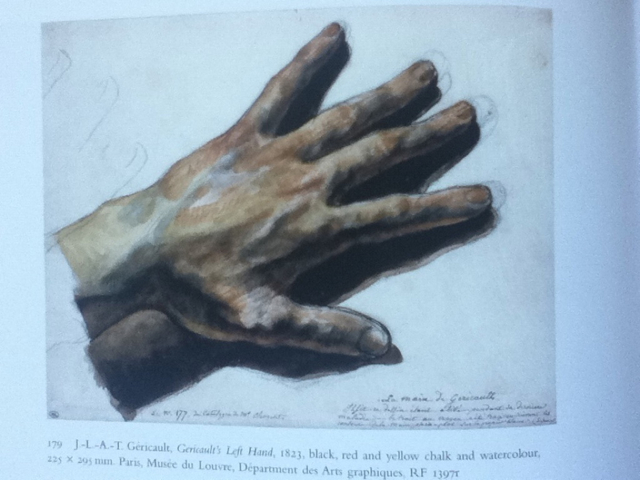 GericaultsLeftHand